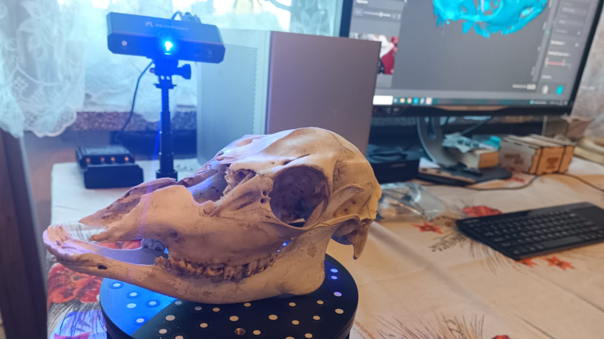 Skanowanie 3D czaszki i szczęki